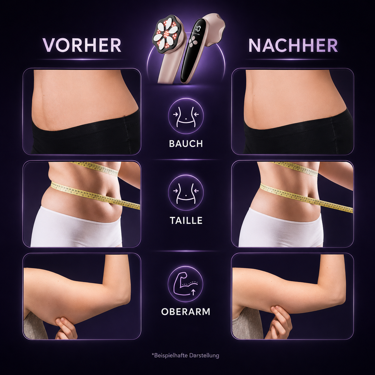 Feelwonder® Anti Cellulite &amp; Lipödem Massagegerät - Pro Edition