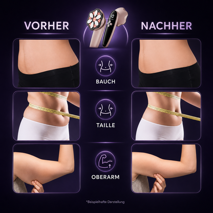 Feelwonder® Anti Cellulite &amp; Lipödem Massagegerät - Pro Edition